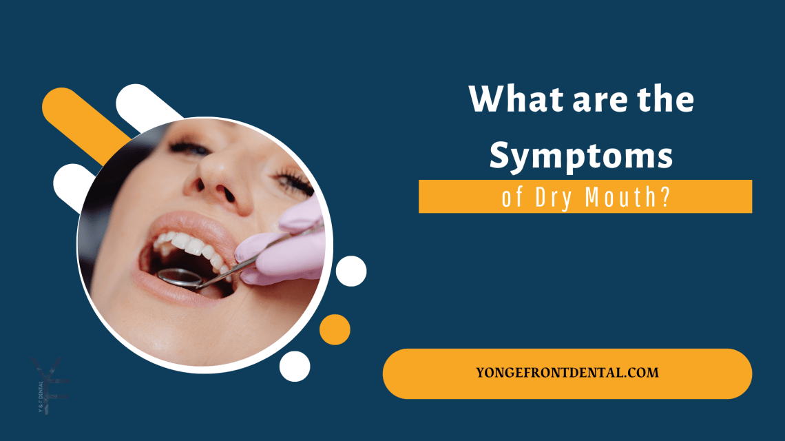 What are the Symptoms of Dry Mouth?