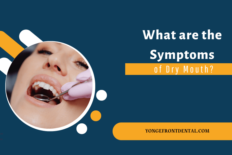 What are the Symptoms of Dry Mouth?