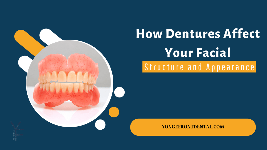 How Dentures Affect Your Facial Structure and Appearance