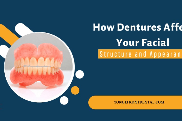 How Dentures Affect Your Facial Structure and Appearance