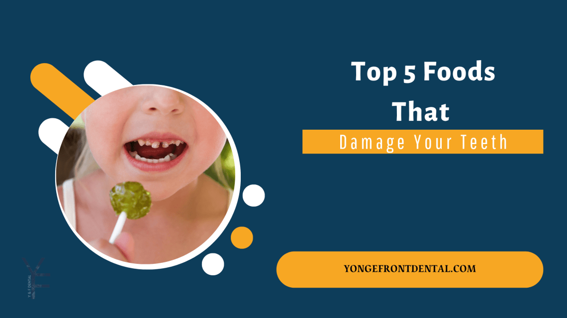 Foods That Damage Your Teeth