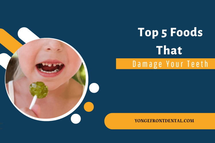 Foods That Damage Your Teeth